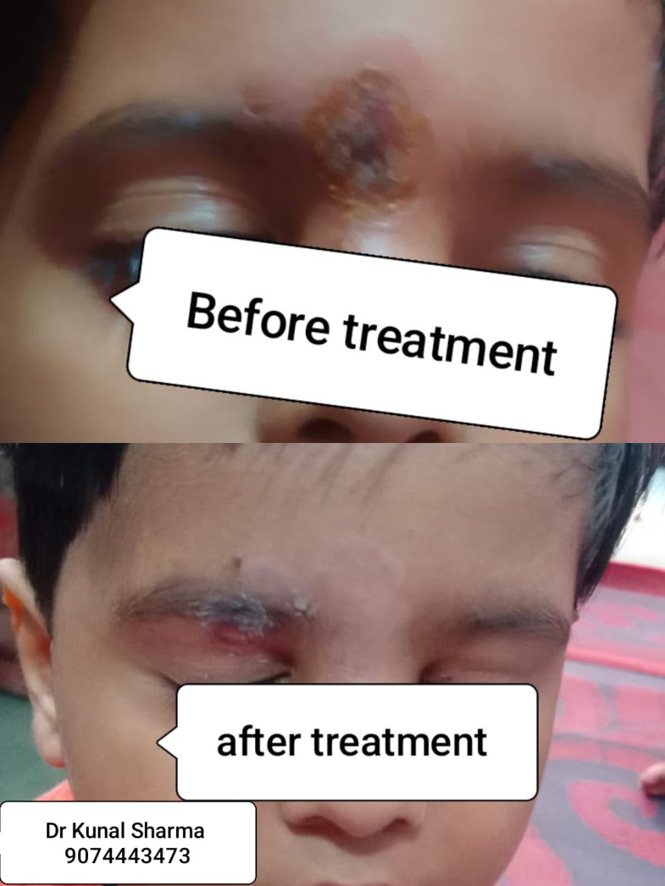 Treatment Report 12