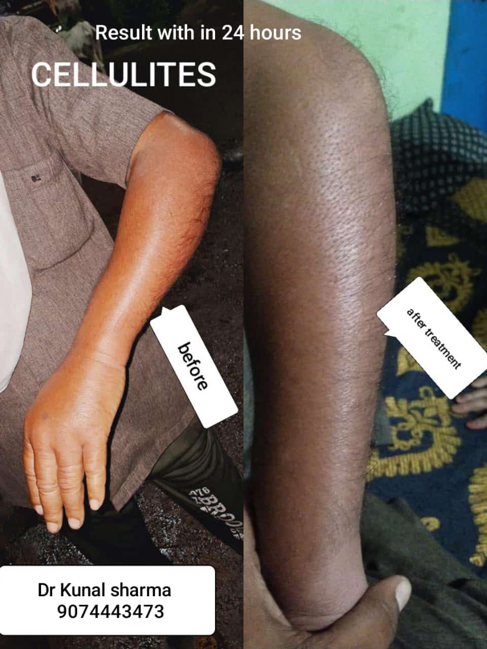 Treatment Report 13