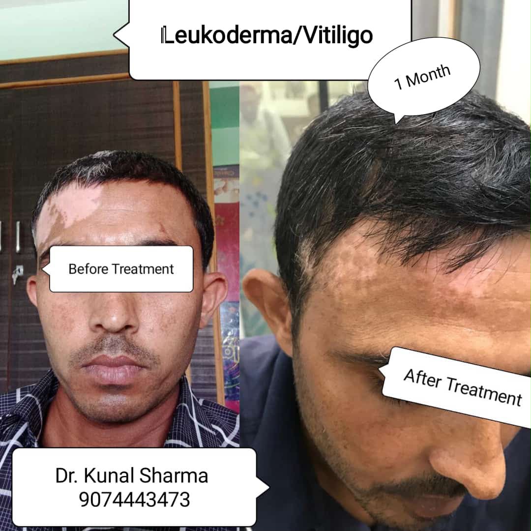 Treatment Report 14