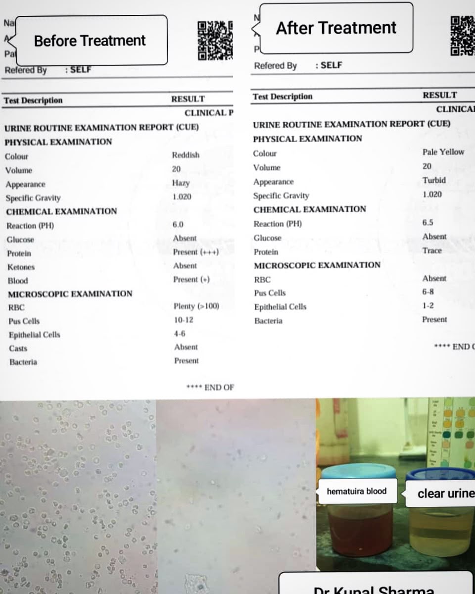 Treatment Report 5