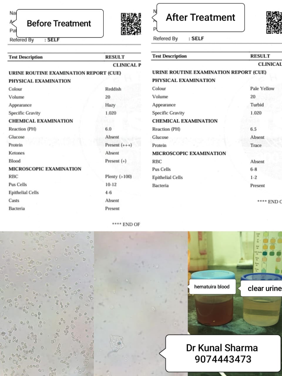 Treatment Report 6